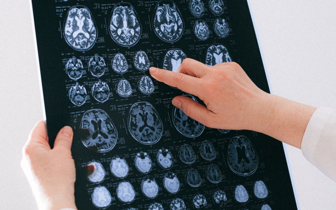 The Economics of an E/M-Heavy Neurology Practice After the Office Visit Changes