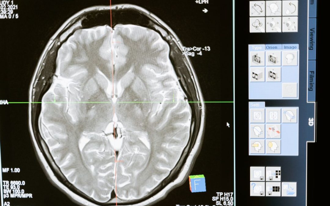 neuro infusion suite
