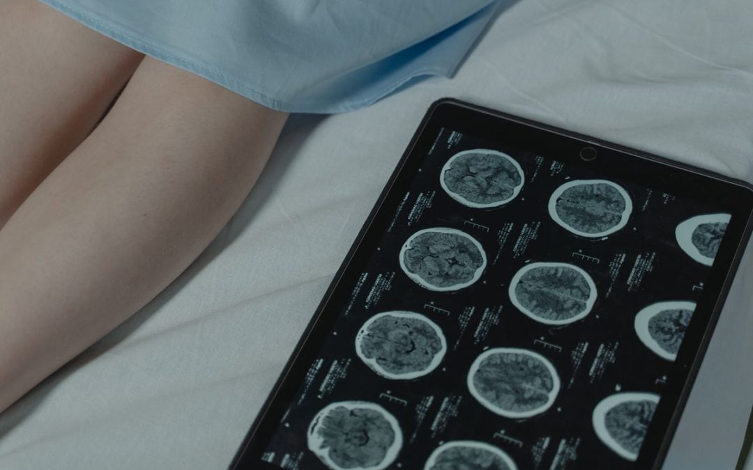 neuro telehealth staffing