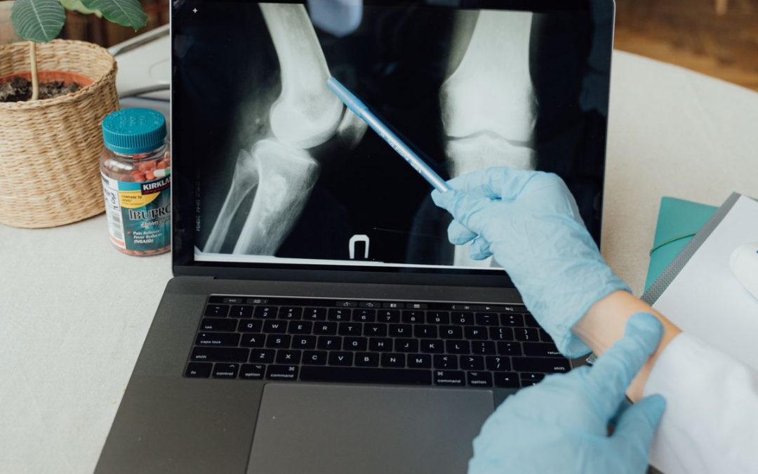 ortho surgical throughput
